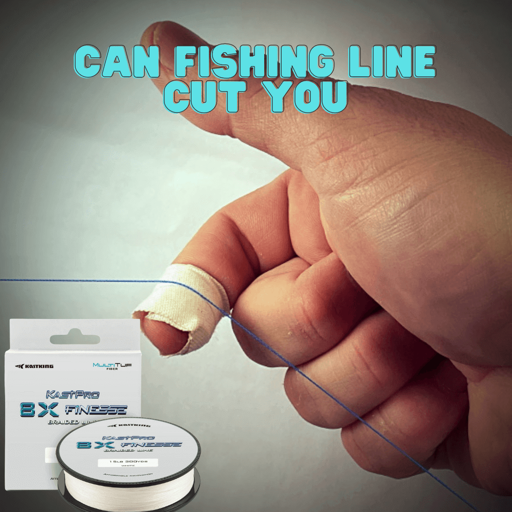 Can a Fishing Line Cut You?